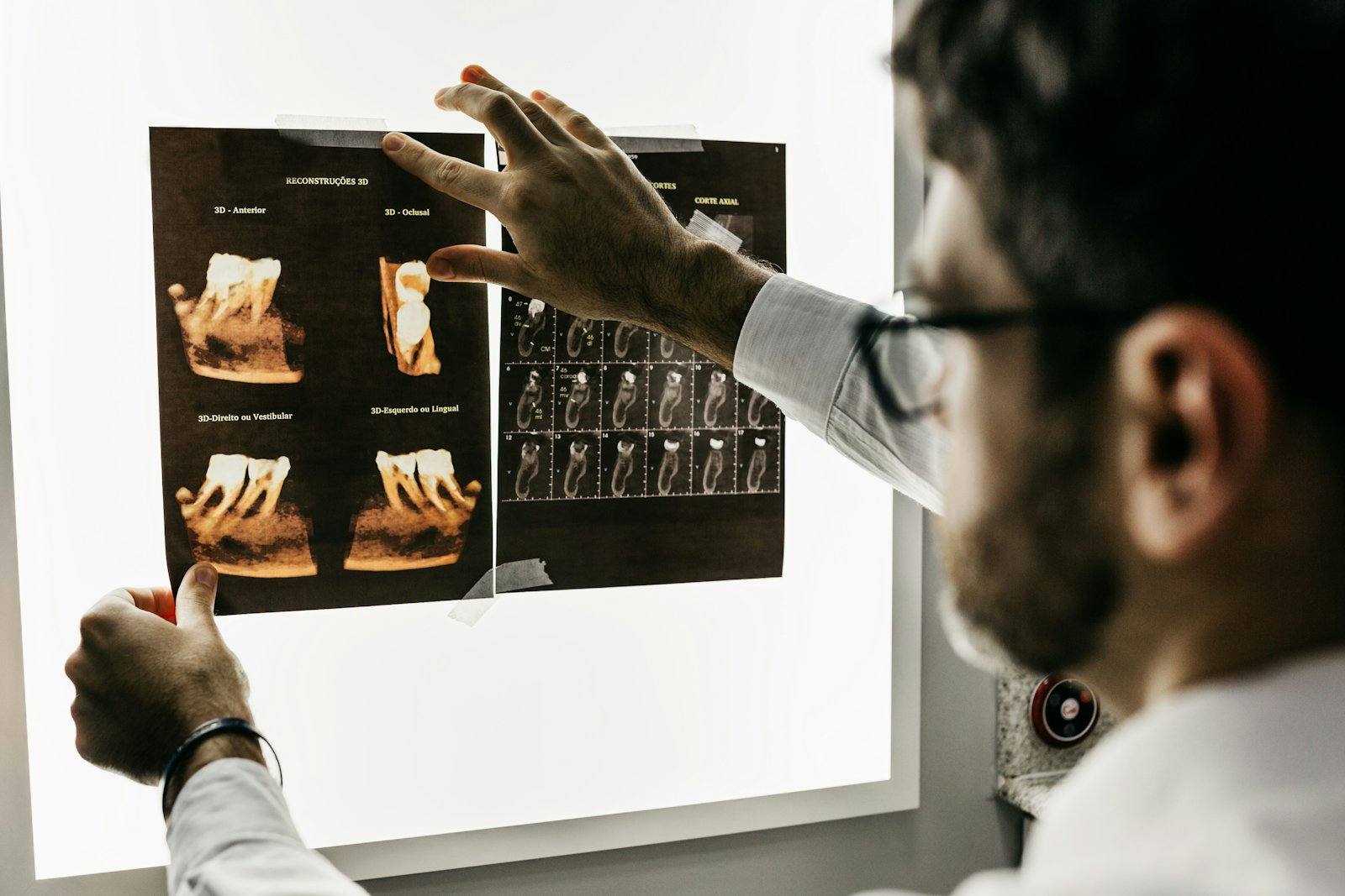 Praticien commentant une radiographie du pied affichée sur un négatoscope, cabinet de podologie à Rennes